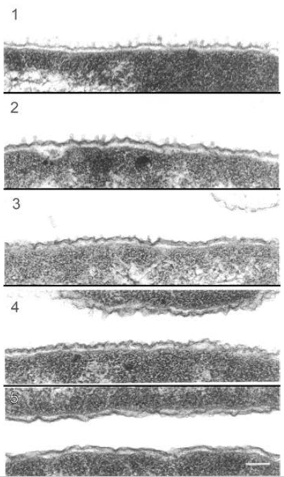 Эффект полимиксинов B.subtilis на ультраструктуру клеточной стенки S.typhimurium – обеспечивают восприимчивость к муромидазе